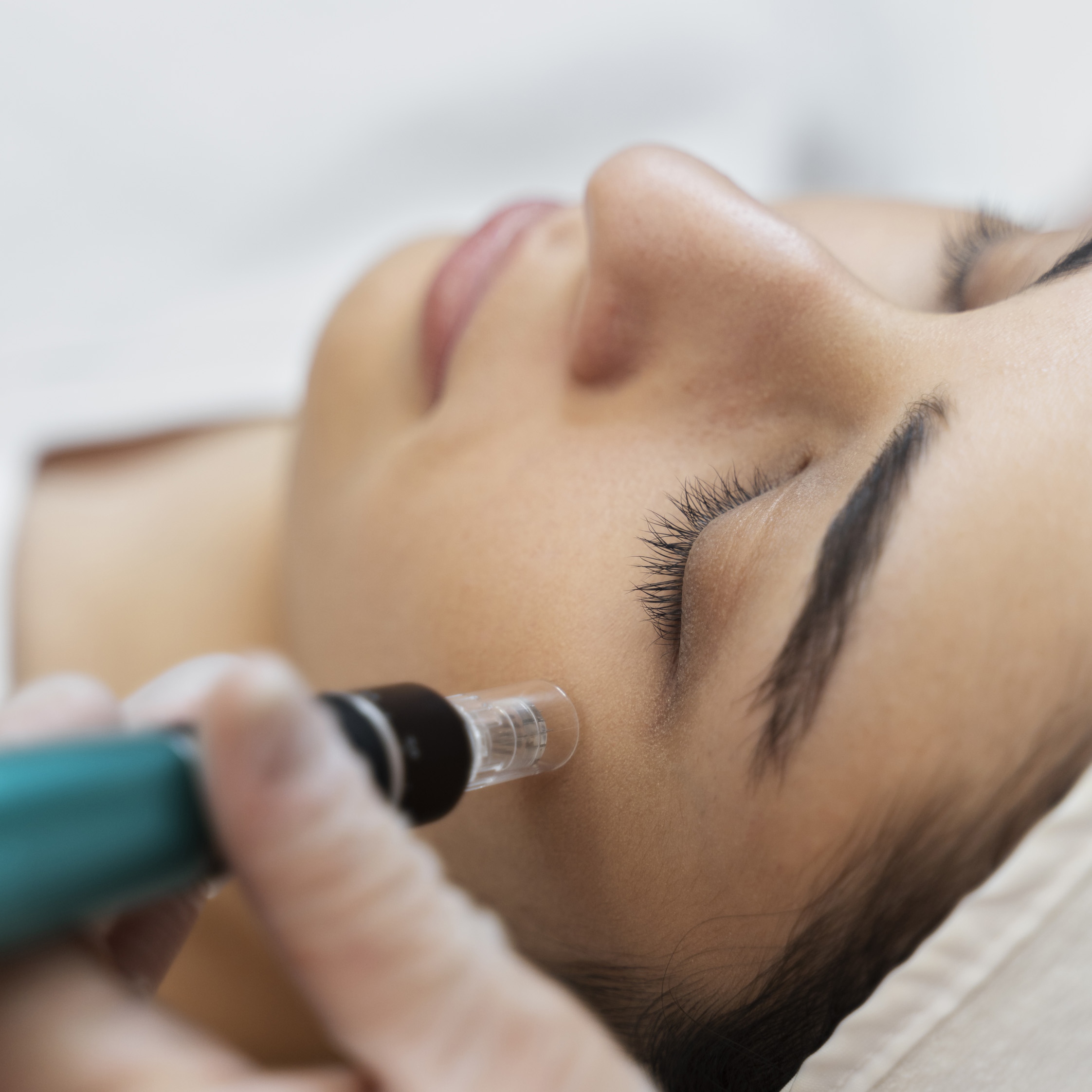 Dermapen